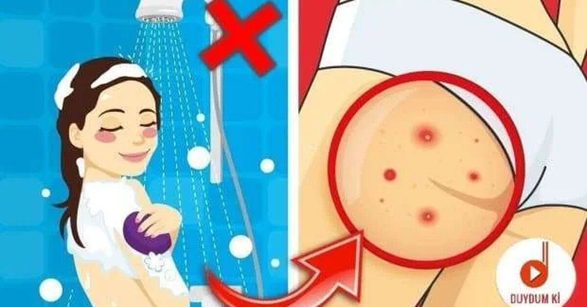 1 Yıl Boyunca Banyo Yapmazsanız Vücudunuzda Ne Olur?