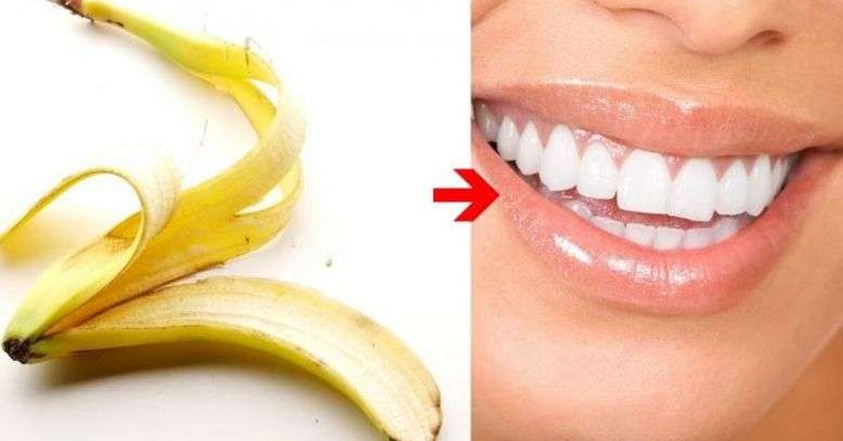 7 Pratik ve İlginç Çözüm ile: Nasıl Daha Beyaz Dişlere Sahip Olunur?