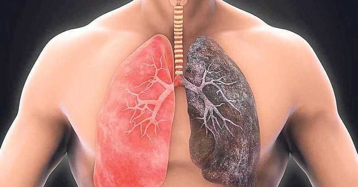 Akciğerleri Temizleyen Süper Gıdalar