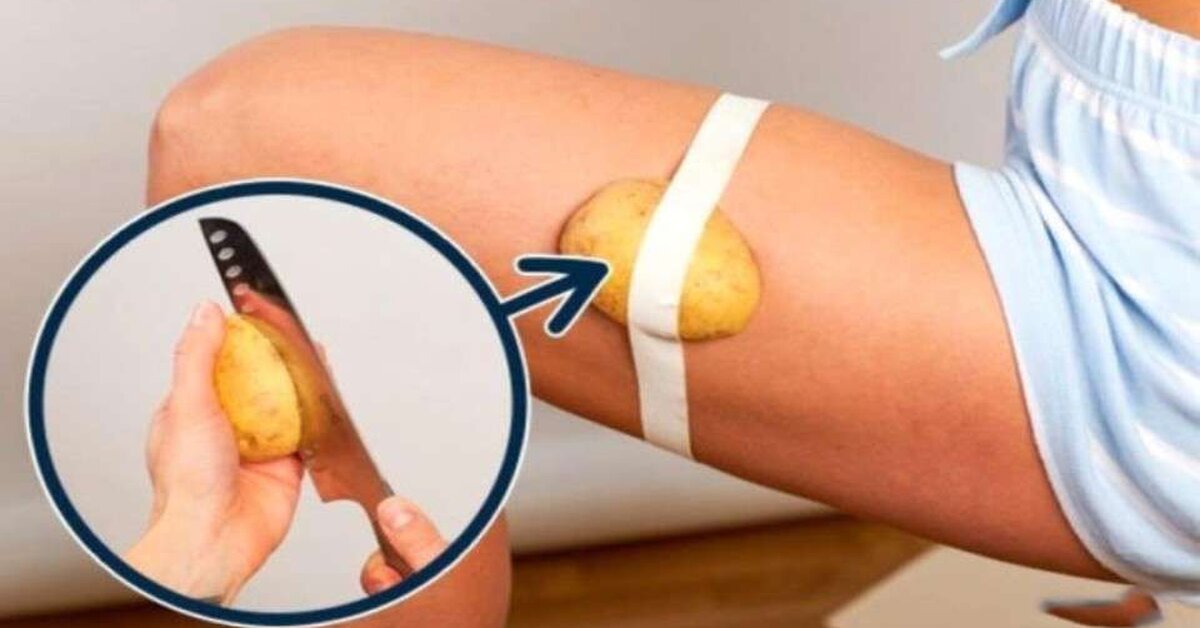 Bacağına Patates Sarıp Uyudu 1 Saat Sonra!