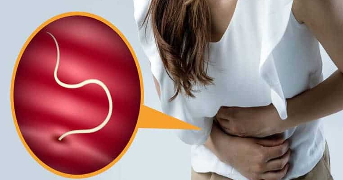 Bağırsak Kurdu Nedir? Belirtileri Nelerdir?