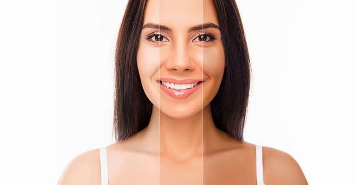 Bembeyaz Bir Cilt İçin Mucizevi Kür