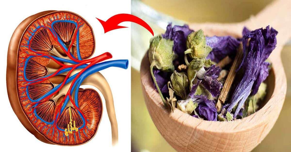 Böbrek Taşlarından Kurtulmak İçin Doğal Kür Tarifi