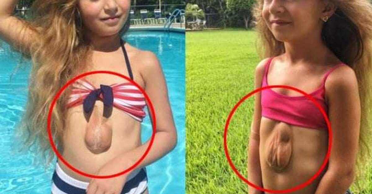 Bu kızın kalbi dışarıda atıyor!