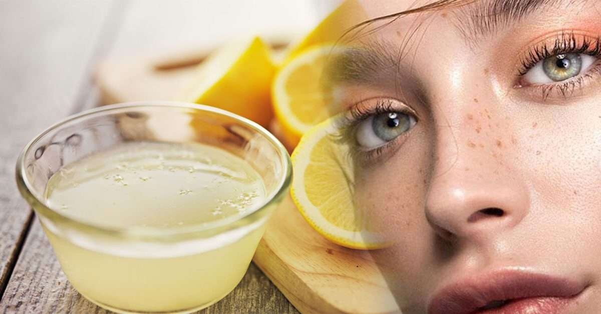 Ciltteki Kahverengi Lekeleri Yok Eden 10 Doğal Kür!