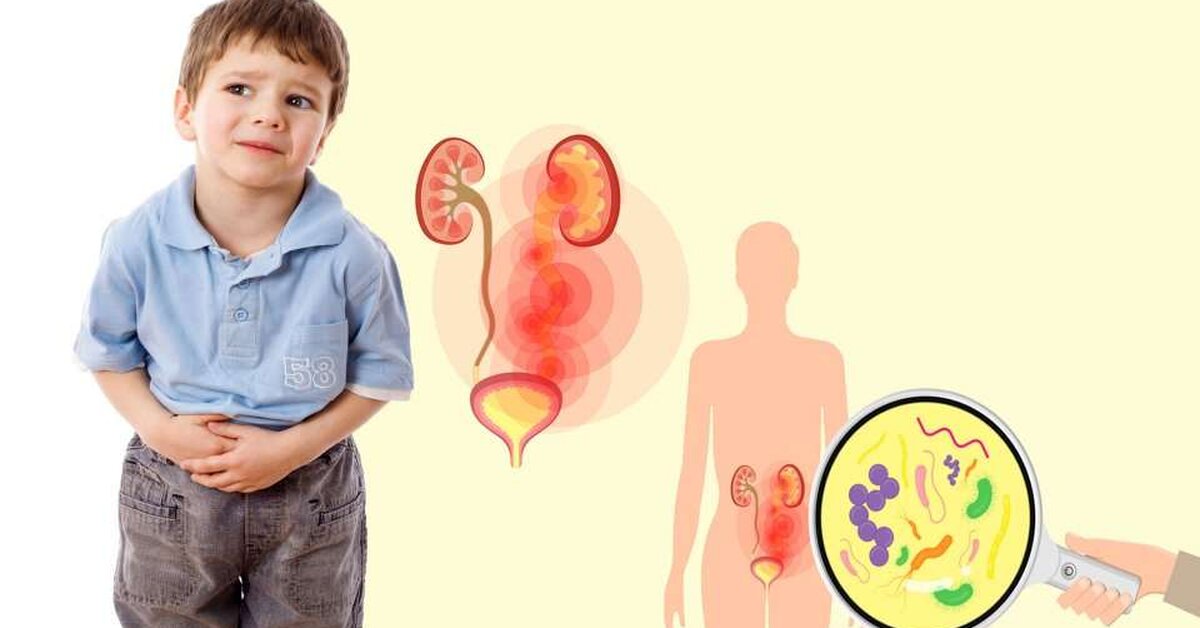 Çocuklarda İdrar Yolu Enfeksiyonu Belirtileri Nelerdir?