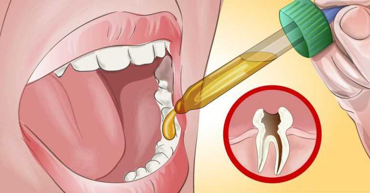 Diş ağrısından kurtulmak için mutlaka deneyin