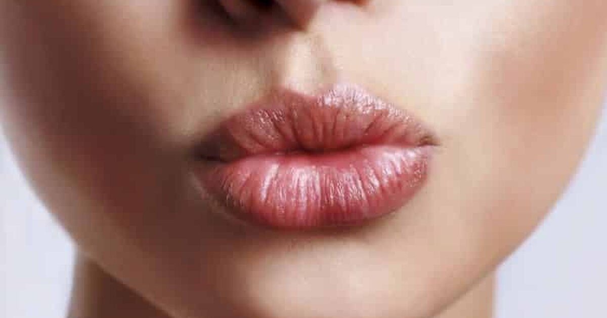 Dudak Çatlakları İçin Ne Yapmalısınız?