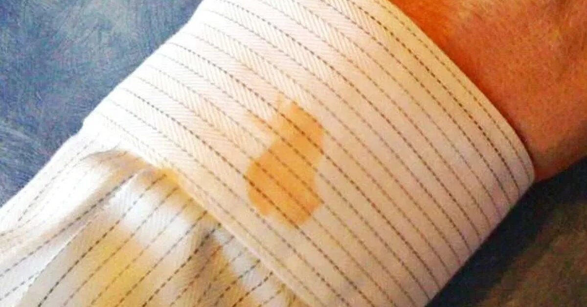 Elma Lekesi Nasıl Çıkar? Meyve Lekelerine Karşı Etkili Yöntemler