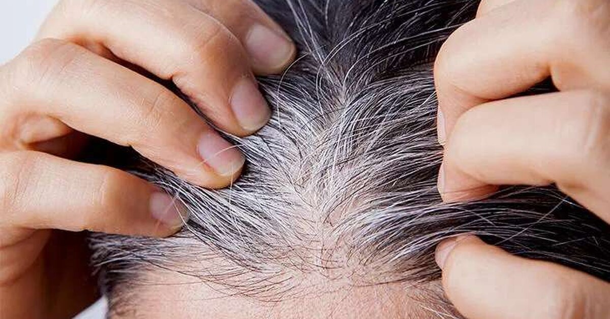 Erken yaşta saçların beyazlamasını engellemenin 4 püf noktası
