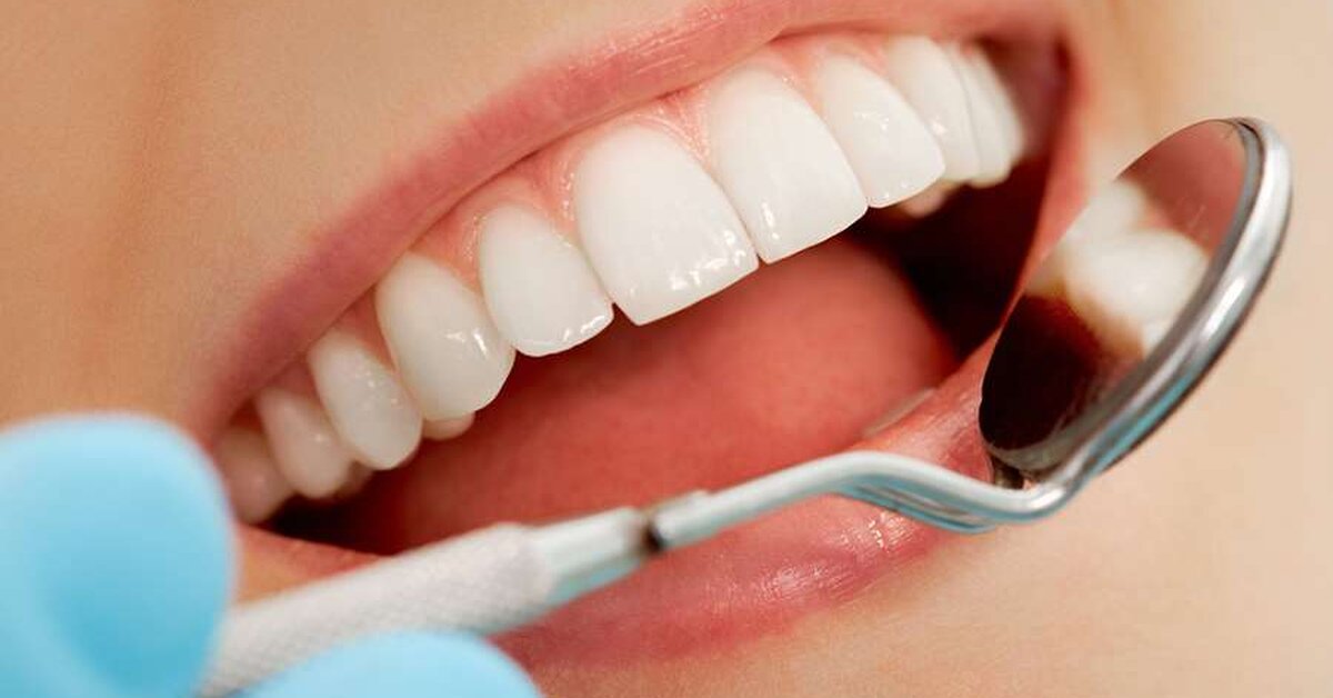 Estetik (Kozmetik) Diş Tedavisinin Avantajları