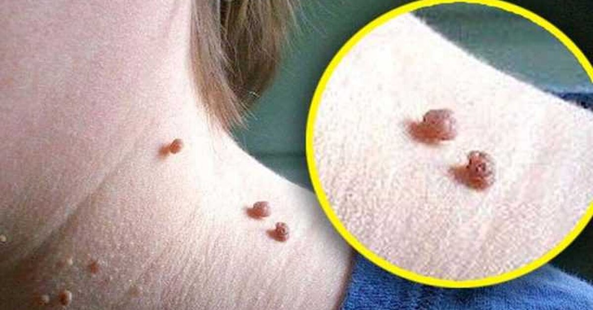 Et Benlerini Patır Patır Döken Tarif!