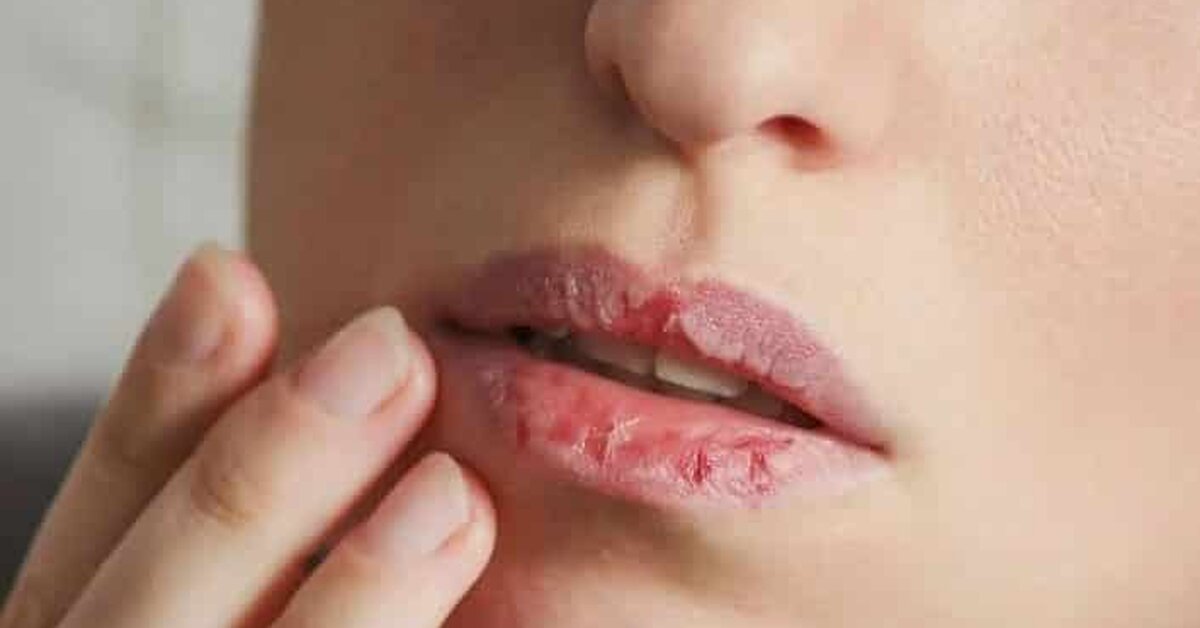 Evde Kolay Dudak Bakımı Nasıl Yapılmalıdır?