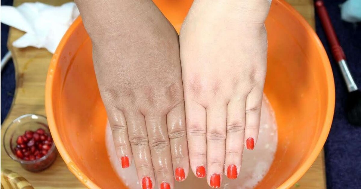 Güneş Lekesi Giderici Bembeyaz Eller İçin Doğal Maske