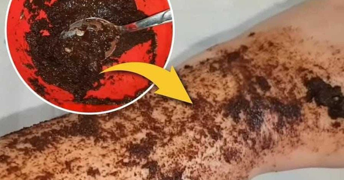 İstenmeyen Tüylerden Sonsuza Dek Kurtulun!