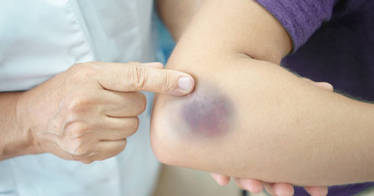 Kalbinizin Düzgün Çalışmadığını Gösteren Belirtiler