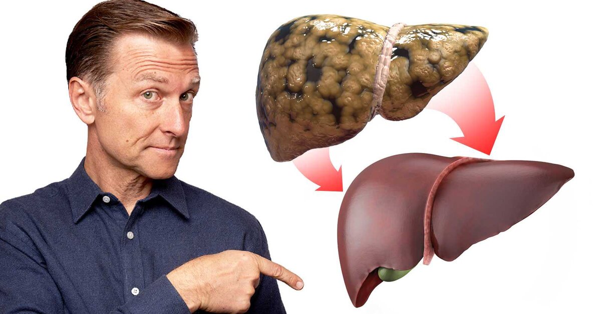 Karaciğeri Doğal Tedavi Eden Gıdalar