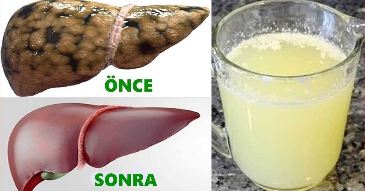 Karaciğeri Yenileyen ve Arındıran Kür Tarifi