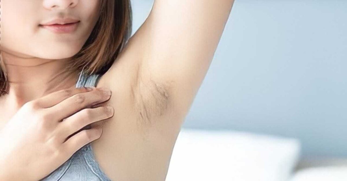 Kararmış Koltuk Altı ve Dizler Nasıl Beyazlatılır?