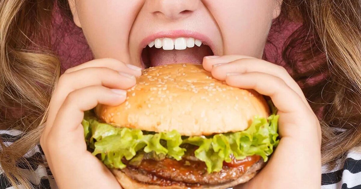 Diyetisyene Bak Hamburger Yiyor!