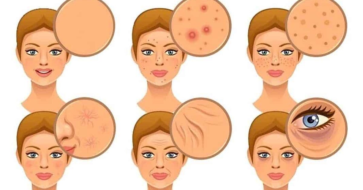 Cildiniz İçin Tehlikeli Olabilecek 7 Gıda