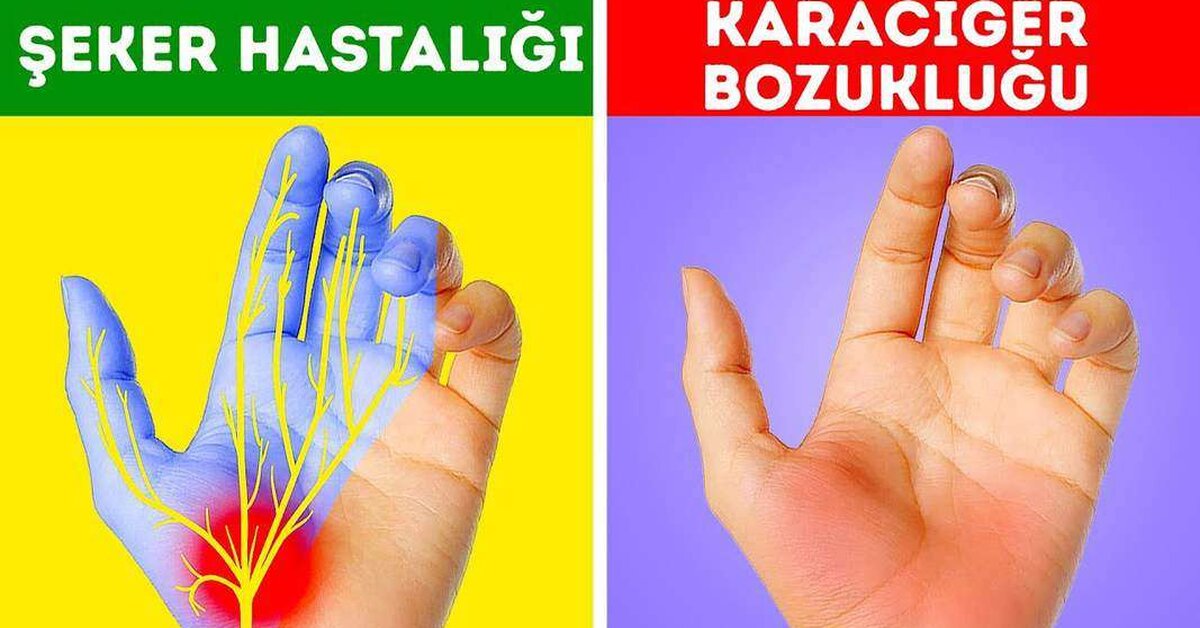 Ellerinizin Sizi Uyardığı 12 Sağlık Sorunu