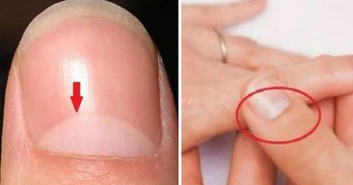 Aslında Bir Dahi Olduğunuzu Gösteren 10 İşaret!