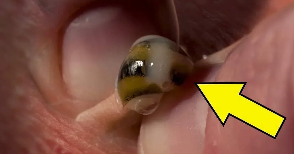 Evinizde Bu Böceği Görürseniz Kaçın ve Yardım İsteyin!