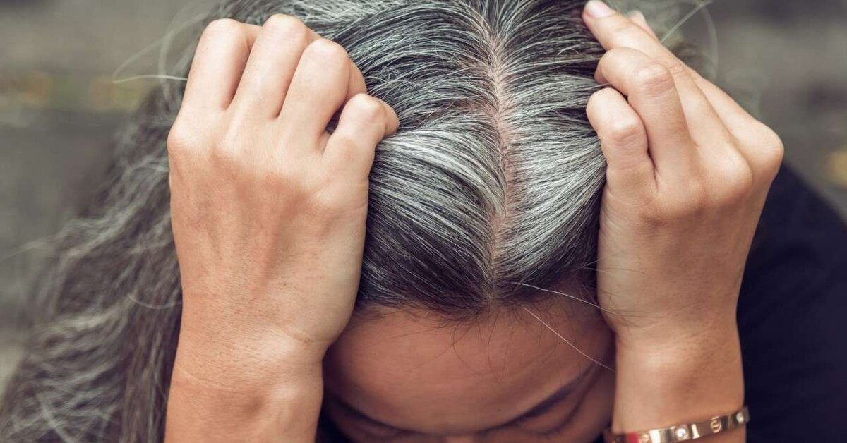 Saç Beyazlamasına Karşı Kür