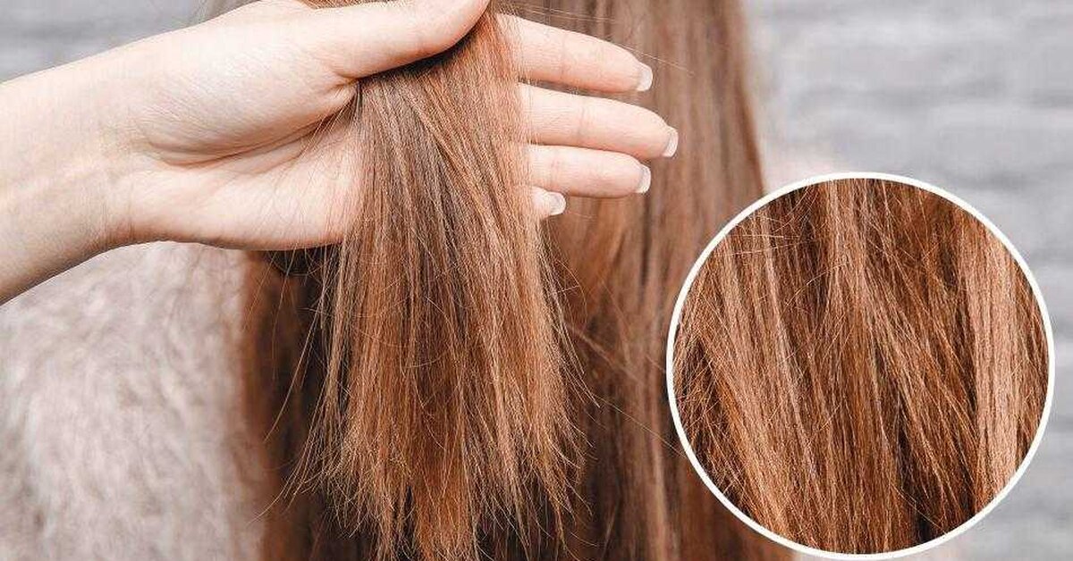 Sağlıksız Saçlar İçin Mucizevi Kür