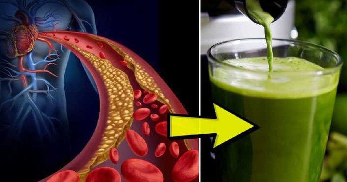 Saraçoğlu’ndan Yüksek Tansiyon Nasıl Düşürülür? Tarifi