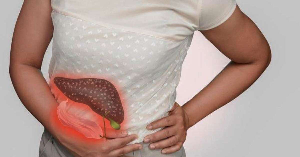 Siroz Hastalığı Tedavisi İçin Bitkisel Kür