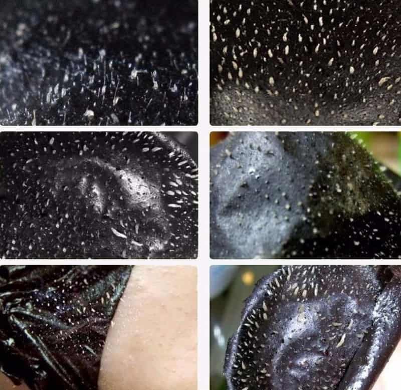 Siyah Noktaları Siyah Maske ile Yok Edin!