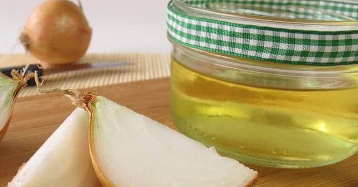 Soğan Suyu ile Doğal Saç Uzatma Kürü