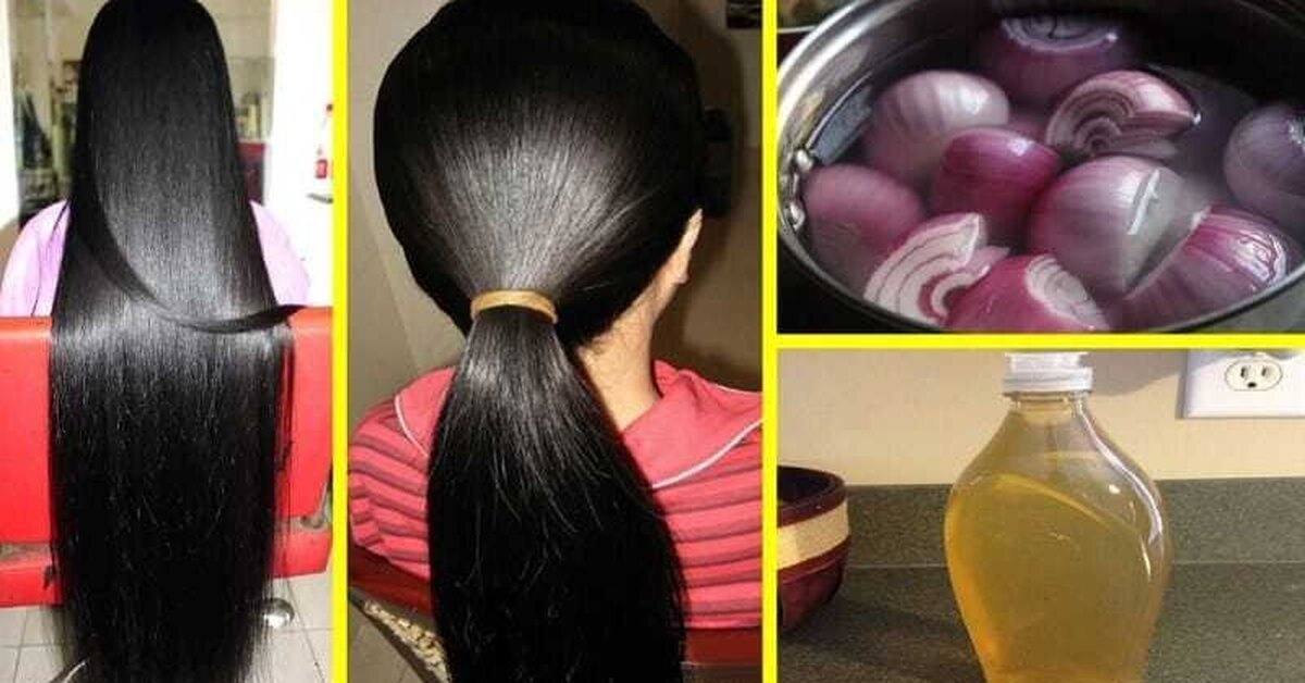 Soğan Suyu Kürü İle Saç Uzatmak Mümkün müdür?