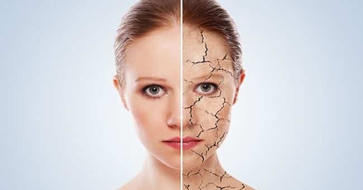 Soğuk Havalarda Cilt Kuruluğu Nasıl Önlenir?