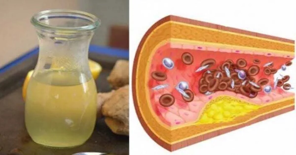 Tansiyon veya Kötü Kolesterol İçin Bitkisel Öneriler