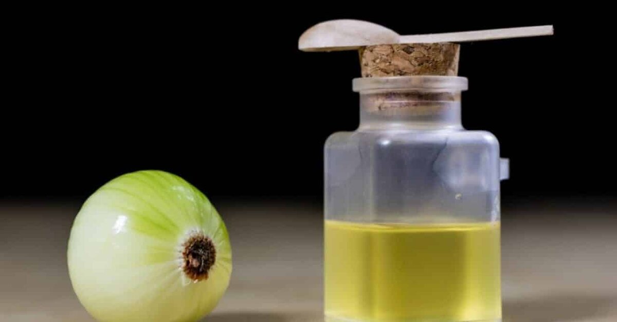 Tüm Cilt Lekelerini Silip Atan Formül: ‘‘Soğan Suyu’’