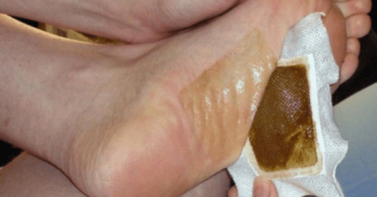 Vücuttaki toksinleri atmak için neler yapılmalıdır?