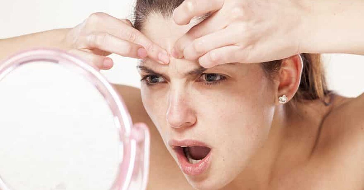 Yetişkin Sivilcelerine Çözüm