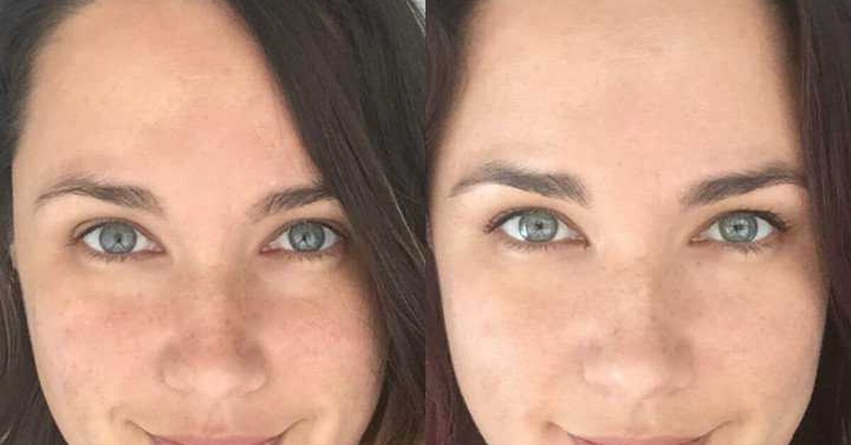 Yüz Beyazlatma Maskesi