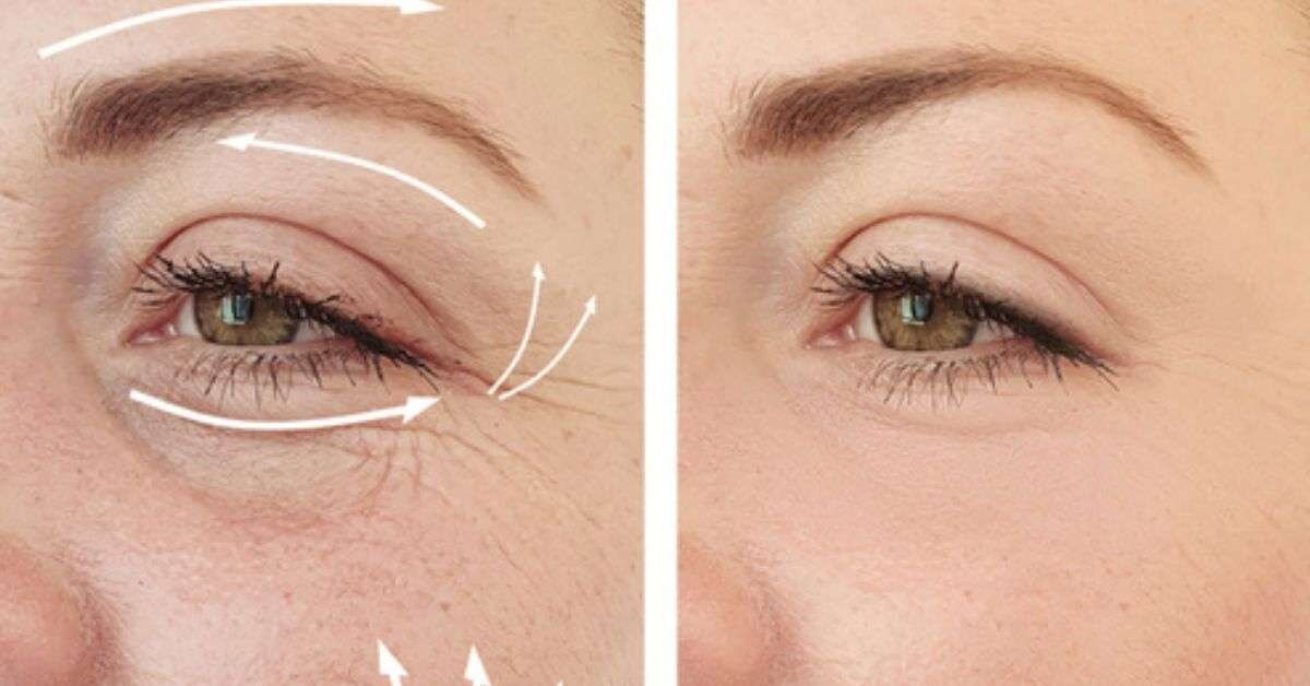 Kırışıklık Giderici, Yaşlanma Karşıtı Kür Tarifi