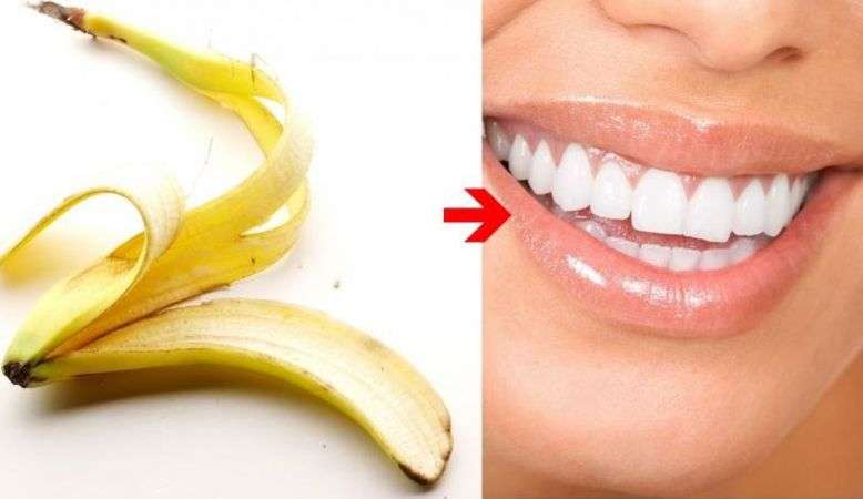 7 Pratik ve İlginç Çözüm ile: Nasıl Daha Beyaz Dişlere Sahip Olunur?