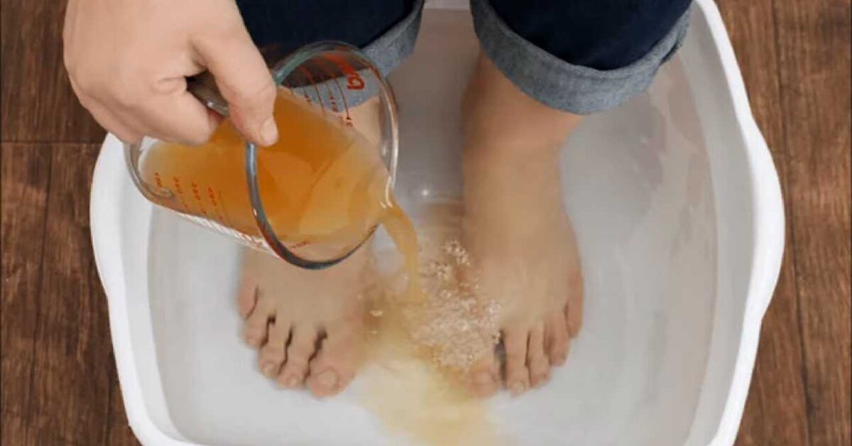 Ayak kokusu neden olur? Ayak kokusu nasıl giderilir?