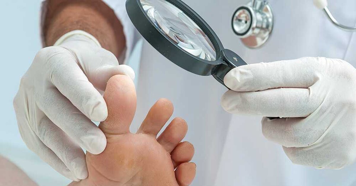 Ayak Mantarını Yok Eden Doğal Yöntemler!