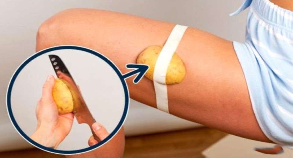 Bacağına Patates Sarıp Uyudu 1 Saat Sonra!