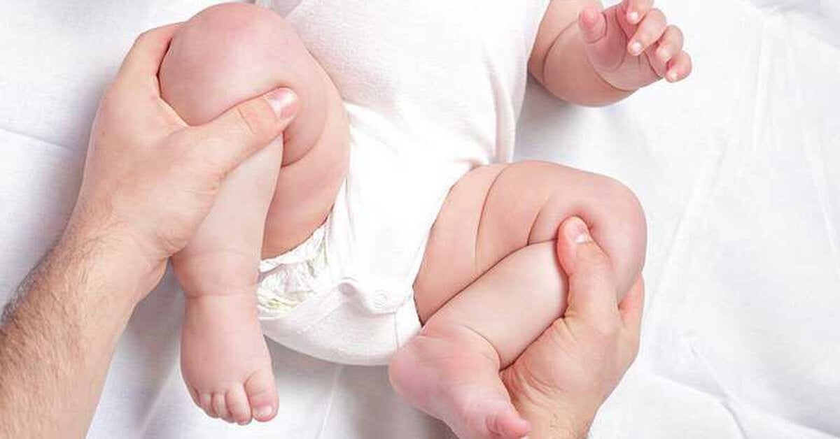 Bebeklerde Kalça Çıkığı Nasıl Anlaşılır ?