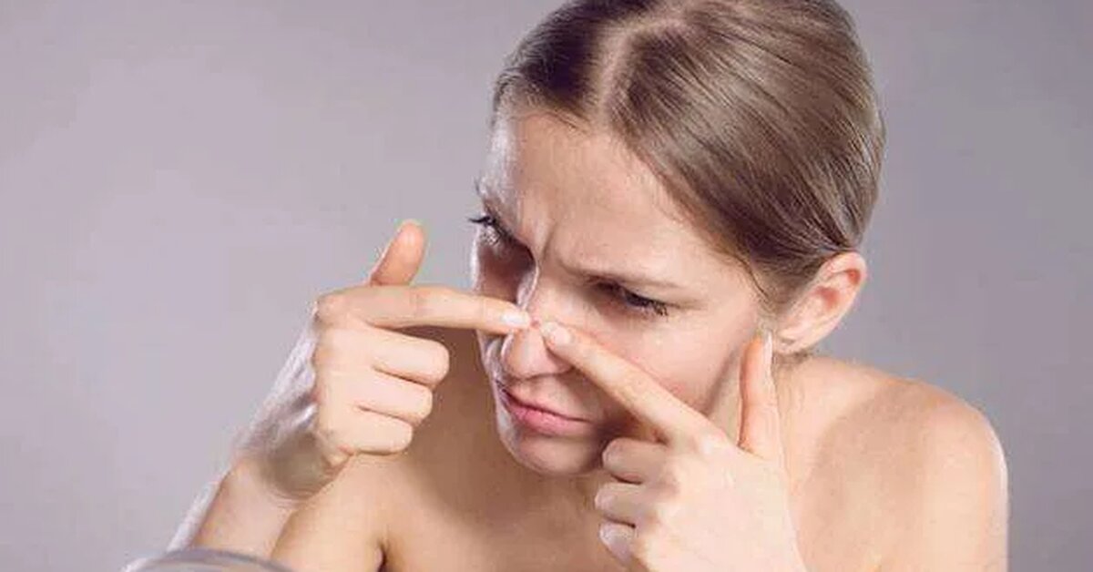 Burundaki Siyah Noktalar İçin Neler Yapılmalıdır?