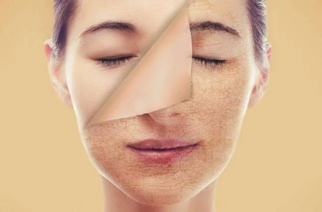 Cilt Kuruluğuna Neler İyi Gelir?