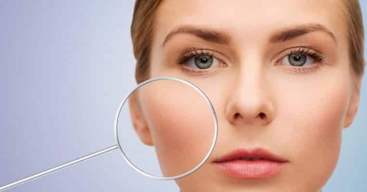 Cilt Tipinizi Biliyor Musunuz?